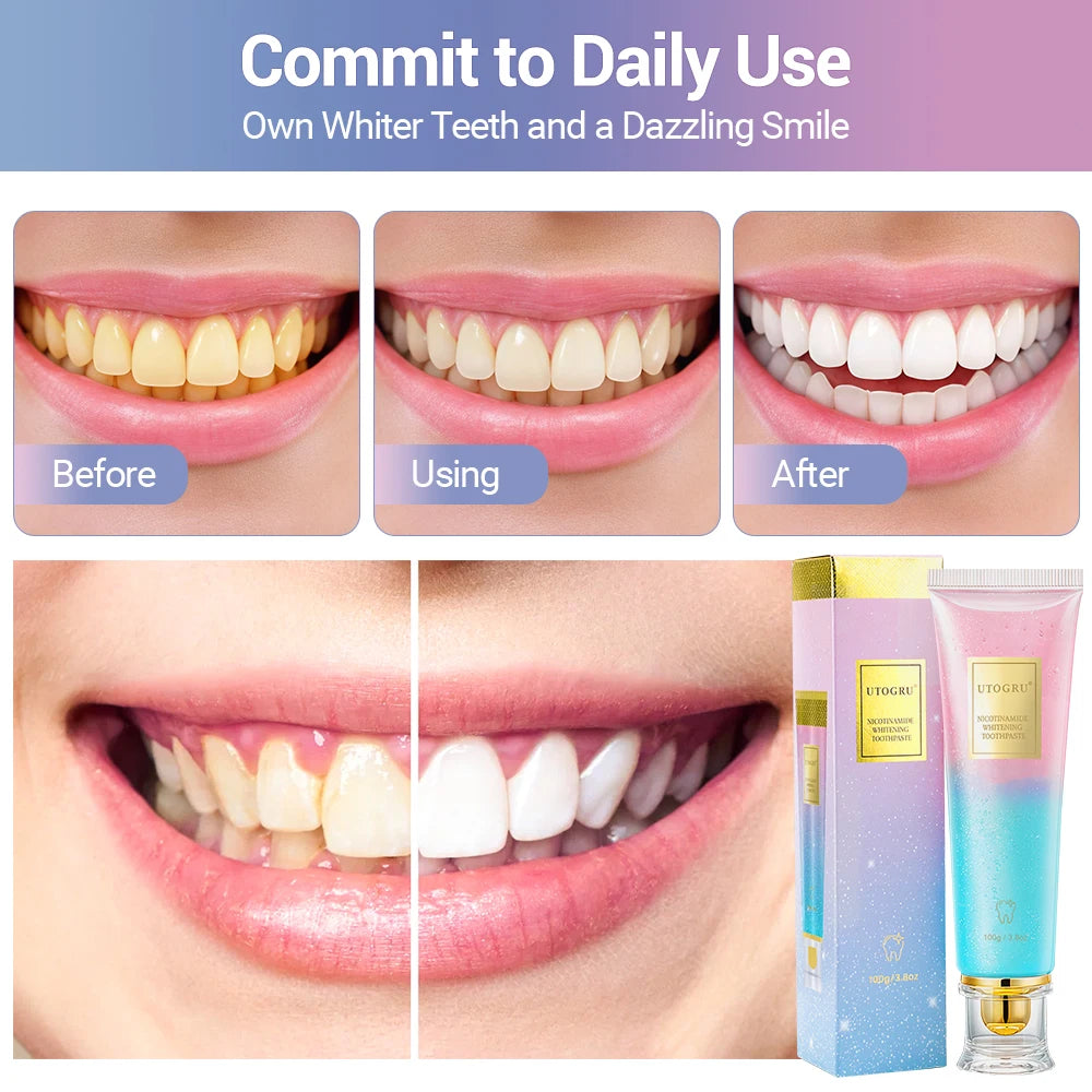 Whitening Toothpaste