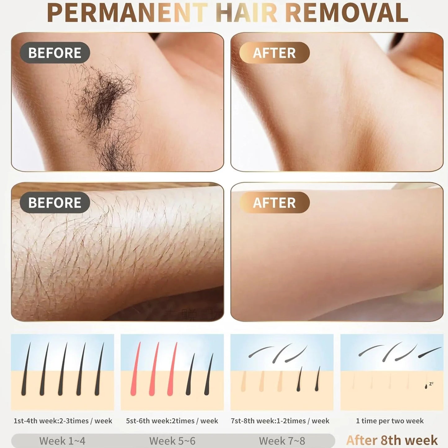 Hair Laser Depilator