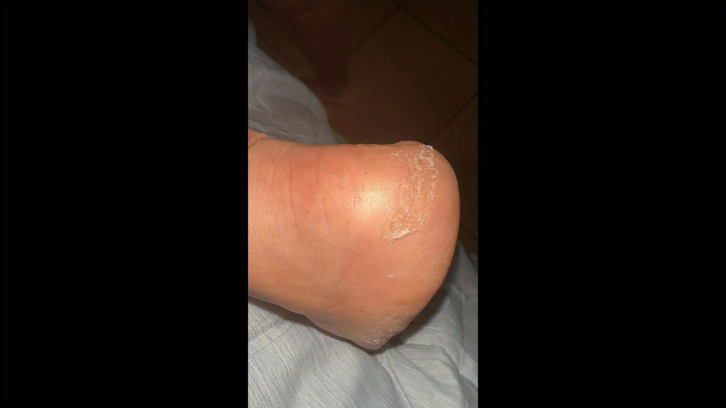 Magic Urea Foot Cream